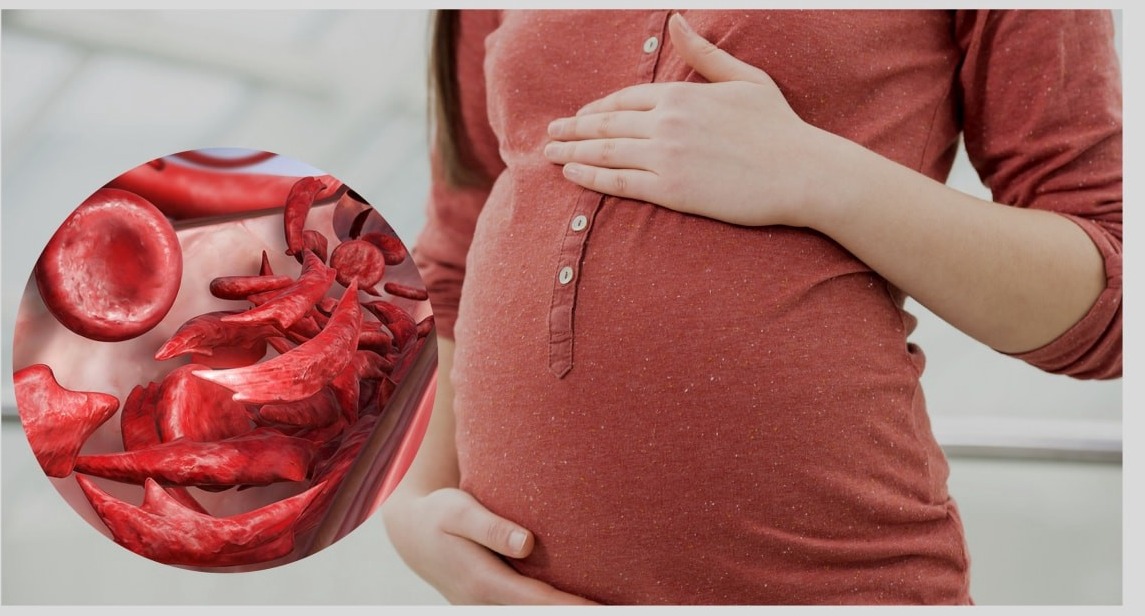 أعراض فقر الدم عند الحامل