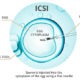 الحقن المجهري خارج الرحم (ICSI)
