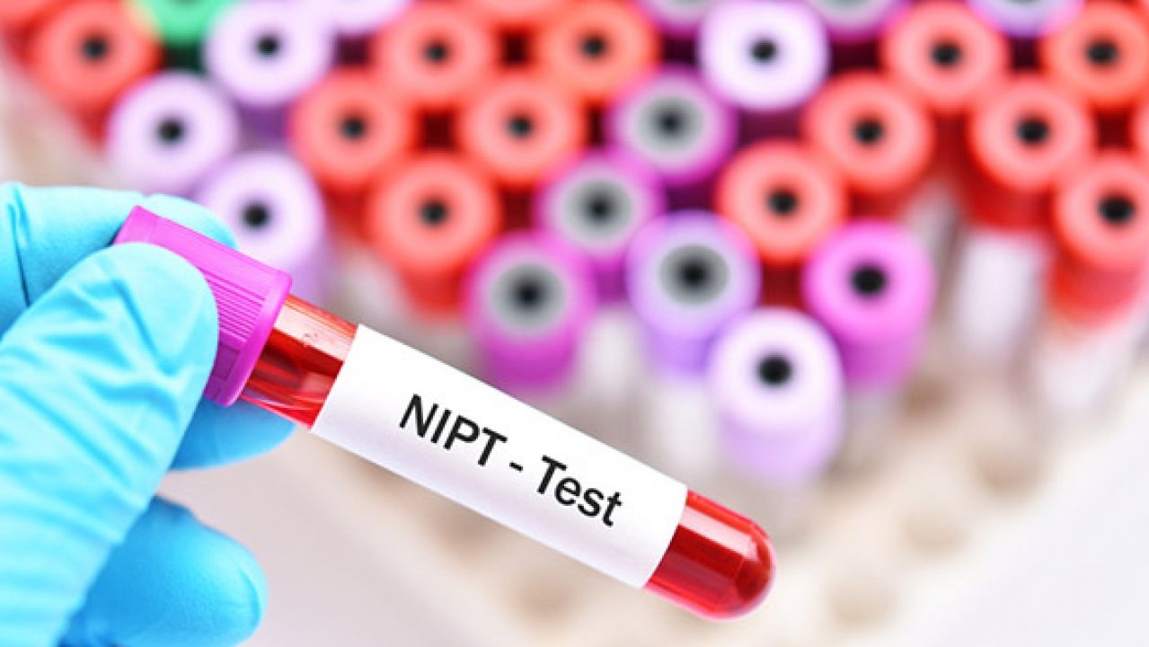 التحليل الجيني NIPT (Non-invasive prenatal  testing)
